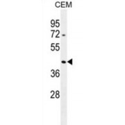 Beta-Actin-Like Protein 3 (ACTBL3) Antibody