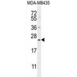 Sesquipedalian-1 (FAM109A) Antibody