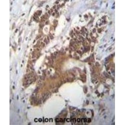 Choline-Phosphate Cytidylyltransferase A (PCYT1A) Antibody