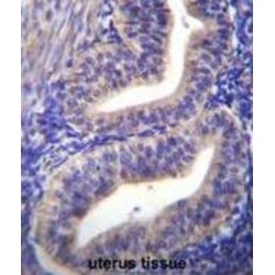 TATA-Box Binding Protein Like 2 (TBPL2) Antibody
