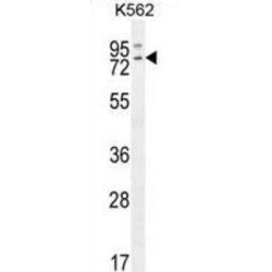 RAS Guanyl Nucleotide-Releasing Protein 2 (RASGRP2) Antibody