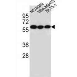 Cholinergic Receptor, Nicotinic Alpha 10 (CHRNA10) Antibody