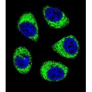 ADP/ATP Translocase 3 (SLC25A6) Antibody