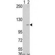 Lysine-Specific Histone Demethylase 1A (LSD1) Antibody