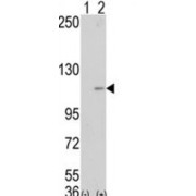 Lysine-Specific Histone Demethylase 1A (LSD1) Antibody