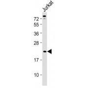 WB analysis of Jurkat whole cell lysates, using TCRB antibody (1/2000 dilution). Predicted band size: 15 kDa. Blocking/Dilution buffer: 5% NFDM/TBST.