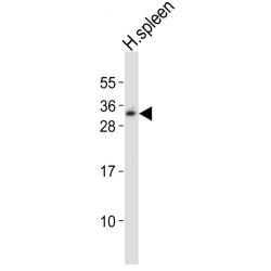 T-Cell Receptor Beta Chain V Region CTL-L17 / TCRB (TRBV7-9) Antibody