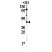 Protein Arginine Methyltransferase 8 (PRMT8) Antibody