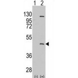 Protein Arginine Methyltransferase 8 (PRMT8) Antibody