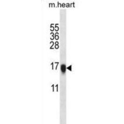 Visinin-Like Protein 1 (VSNL1) Antibody