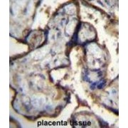 abx026655