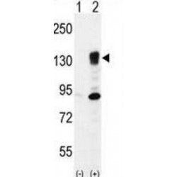 Integrin Alpha 5 (ITGA5) Antibody