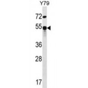Zinc Finger Protein 14 (ZFP14) Antibody