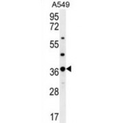 Olfactory Receptor 4M1 (OR4M1) Antibody