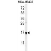 abx026665