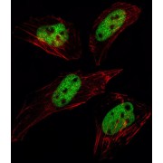 Small Ubiquitin Related Modifier Protein 1 (SUMO1) Antibody