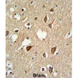 Small Ubiquitin Related Modifier Protein 1 (SUMO1) Antibody