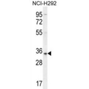 SFTPA2B Antibody