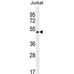 Smad Nuclear-Interacting Protein 1 (SNIP1) Antibody