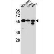 Forkhead Box Protein N2 (FOXN2) Antibody