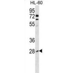 Rho-Related GTP-Binding Protein RhoB (ARHB) Antibody