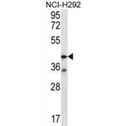Proteinase Activated Receptor 3 (F2RL2) Antibody