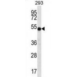 V-Type Proton ATPase Subunit B, Kidney Isoform (ATP6V1B1) Antibody
