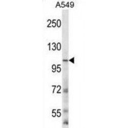 Glutamate Receptor Ionotropic, NMDA 3B (GRIN3B) Antibody