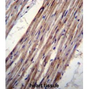 Potassium Voltage-Gated Channel Subfamily J Member 8 (KCNJ8) Antibody