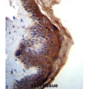 Interleukin-1 Family Member 5 (IL1F5) Antibody