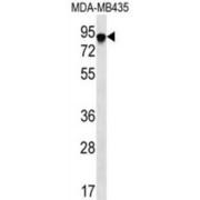 FYN-Binding Protein 1 (FYB1) Antibody