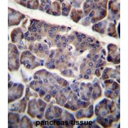 Programmed Cell Death Protein 1 Ligand 2 (PDCD1LG2) Antibody