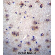 Envoplakin-Like Protein (EVPLL) Antibody