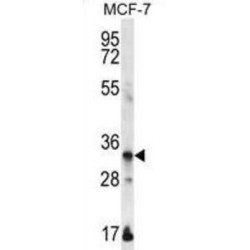 Envoplakin-Like Protein (EVPLL) Antibody