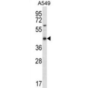 Olfactory Receptor Family 51 Subfamily S Member 1 (OR51S1) Antibody