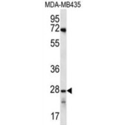 Olfactory Receptor Family 10 Subfamily AG Member 1 (OR10AG1) Antibody