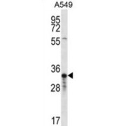 Olfactory Receptor 4F5 (OR4F5) Antibody
