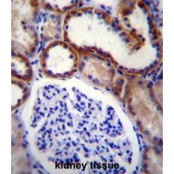 Mitogen-Activated Protein Kinase Kinase Kinase 15 (MAP3K15) Antibody