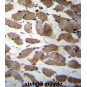 Actinin Alpha 3 (ACTN3) Antibody