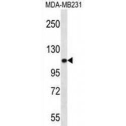 Actinin Alpha 3 (ACTN3) Antibody