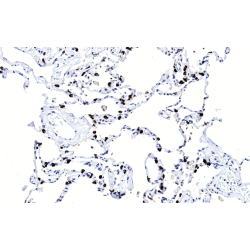 Pulmonary Surfactant Associated Protein C (SFTPC) Antibody
