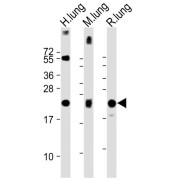 WB analysis of (1) Human lung lysate, (2) Mouse lung lysate, and (3) Rat lung lysate, using SFTPC Antibody (1/2000 dilution). Predicted band size: 21 kDa. Blocking/Dilution buffer: 5% NFDM/TBST.