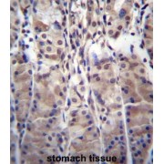 Mdm1 Nuclear Protein (MDM1) Antibody