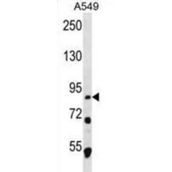 Mdm1 Nuclear Protein (MDM1) Antibody