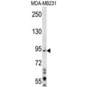 Mitotic Spindle Assembly Checkpoint Protein MAD1 (MAD1L1) Antibody