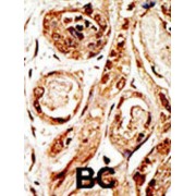 SUMO1/Sentrin/SMT3 Specific Peptidase 3 (SENP3) Antibody