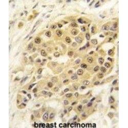 SUMO1/Sentrin/SMT3 Specific Peptidase 3 (SENP3) Antibody