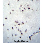 Zinc Finger Protein 417 (ZNF417) Antibody