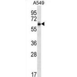 Zinc Finger Protein 417 (ZNF417) Antibody
