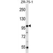 Zinc Finger Protein 845 (ZNF845) Antibody